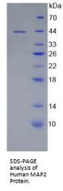 Human Microtubule Associated Protein 2 (MAP2) Protein