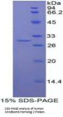 Human Mindbomb Homolog 2 (MIB2) Protein
