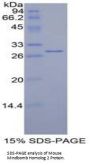 Mouse Mindbomb Homolog 2 (MIB2) Protein
