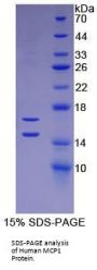 Human C-C Motif Chemokine 2 / MCP1 (CCL2) Protein