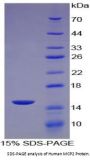 Human C-C Motif Chemokine 8 / MCP2 (CCL8) Protein