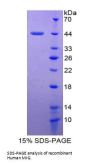 Human Monokine Induced By Interferon Gamma (MIg) Protein