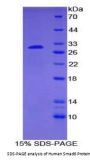 Human Mothers Against Decapentaplegic Homolog 6 (Smad6) Protein