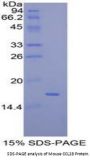 Mouse C-C Motif Chemokine 28 / MEC (CCL28) Protein