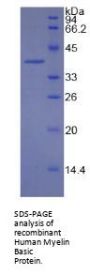 Human Myelin Basic Protein (MBP) Protein