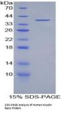 Human Myelin Basic Protein (MBP) Protein