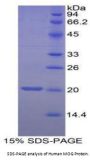 Human Myelin Oligodendrocyte Glycoprotein (MOG) Protein