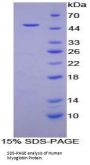 Human Myoglobin (MB) Protein