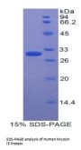Human Myosin IE (MYO1E) Protein