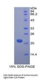 Human Myosin Light Chain 12A (MYL12A) Protein