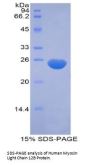 Human Myosin Light Chain 12B (MYL12B) Protein