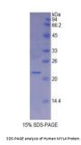 Human Myosin Light Chain 4, Alkali, Atrial, Embryonic (MYL4) Protein