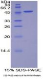 Rat Myosin Light Chain 6B, Alkali, Smooth Muscle And Non Muscle (MYL6B) Protein