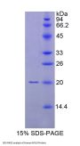 Human Myosin Light Chain 9, Regulatory (MYL9) Protein