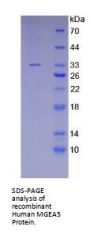 Human Protein O-GlcNAcase / MGEA5 (OGA) Protein