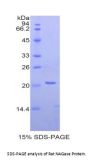 Rat Protein O-GlcNAcase / MGEA5 (OGA) Protein