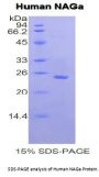 Human N-Acetylgalactosaminidase Alpha (NAGA) Protein