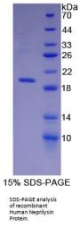 Human Neprilysin / NEP (MME) Protein