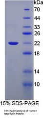 Human Neprilysin / NEP (MME) Protein