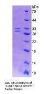 Human Nerve Growth Factor (NGF) Protein