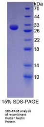 Human Nestin (NES) Protein