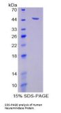 Human Neuraminidase (NEU) Protein