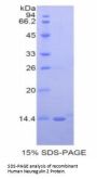 Human Neuregulin 2 (NRG2) Protein