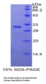 Human Neurofascin (NFASC) Protein