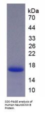 Human Neurokinin B (NKB) Protein