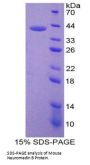 Mouse Neuromedin B (NMB) Protein