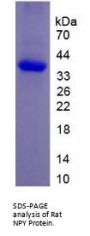 Rat Neuropeptide Y (NPY) Protein
