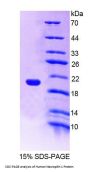 Human Neuropilin 1 (NRP1) Protein