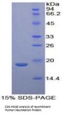 Human Neurotensin (NT) Protein