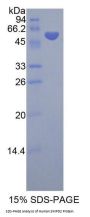 Human Sphingomyelin Phosphodiesterase 2 (SMPD2) Protein