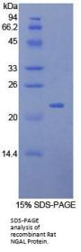 Rat Neutrophil Gelatinase Associated Lipocalin / NGAL (LCN2) Protein