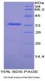 Rat Never In Mitosis Gene A Related Kinase 2 (NEK2) Protein