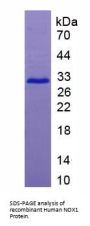 Human Nicotinamide Adenine Dinucleotide Phosphate Oxidase 1 (NOX1) Protein