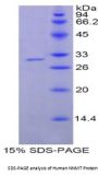 Human Nicotinamide-N-Methyltransferase (NNMT) Protein