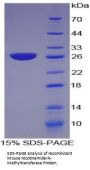 Mouse Nicotinamide-N-Methyltransferase (NNMT) Protein
