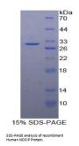 Human Nitric Oxide Synthase Interacting Protein (NOSIP) Protein