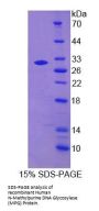 Human N-Methylpurine DNA Glycosylase (MPG) Protein