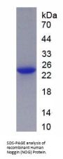 Human Noggin (NOG) Protein