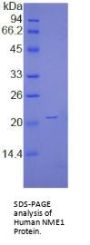 Human Non Metastatic Cells 1, Protein NM23A Expressed In (NME1) Protein