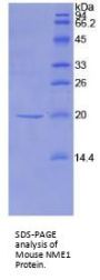 Mouse Non Metastatic Cells 1, Protein NM23A Expressed In (NME1) Protein
