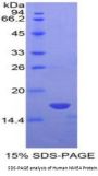 Human Non Metastatic Cells 4, Protein NM23A Expressed In (NME4) Protein