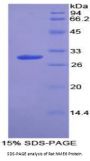 Rat Non Metastatic Cells 6, Protein Expressed In (NME6) Protein