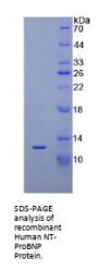Human N-Terminal Pro Brain Natriuretic Peptide (NT-ProBNP) Protein