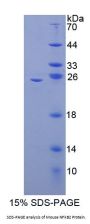 Mouse Nuclear Factor Kappa B2 (NFkB2) Protein