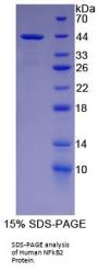 Human Nuclear Factor Kappa B2 (NFkB2) Protein