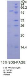 Human Nucleolin (NCL) Protein